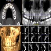 رادیو گرافی CBCT