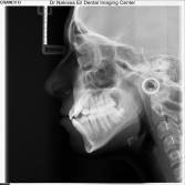 Cephalometry