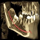 CBCT