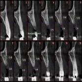 CBCT