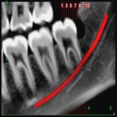 CBCT