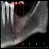 CBCT